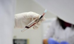 Ученые научились по капле крови определять наличие раковой опухоли