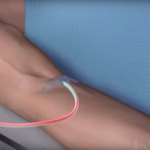 Переливание крови и ее компонентов