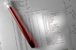 9 ПОКАЗАТЕЛЕЙ КРОВИ, ОТКРЫВАЮЩИХ ВСЁ, О ВАШЕМ ОРГАНИЗМЕ!