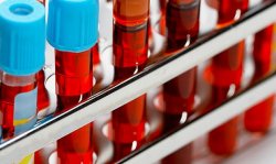 Вот что группа крови может рассказать о вашей личности