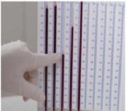 Что такое СОЭ?